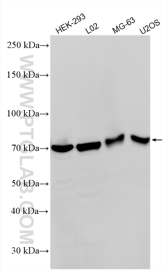 WB analysis using 21526-1-AP