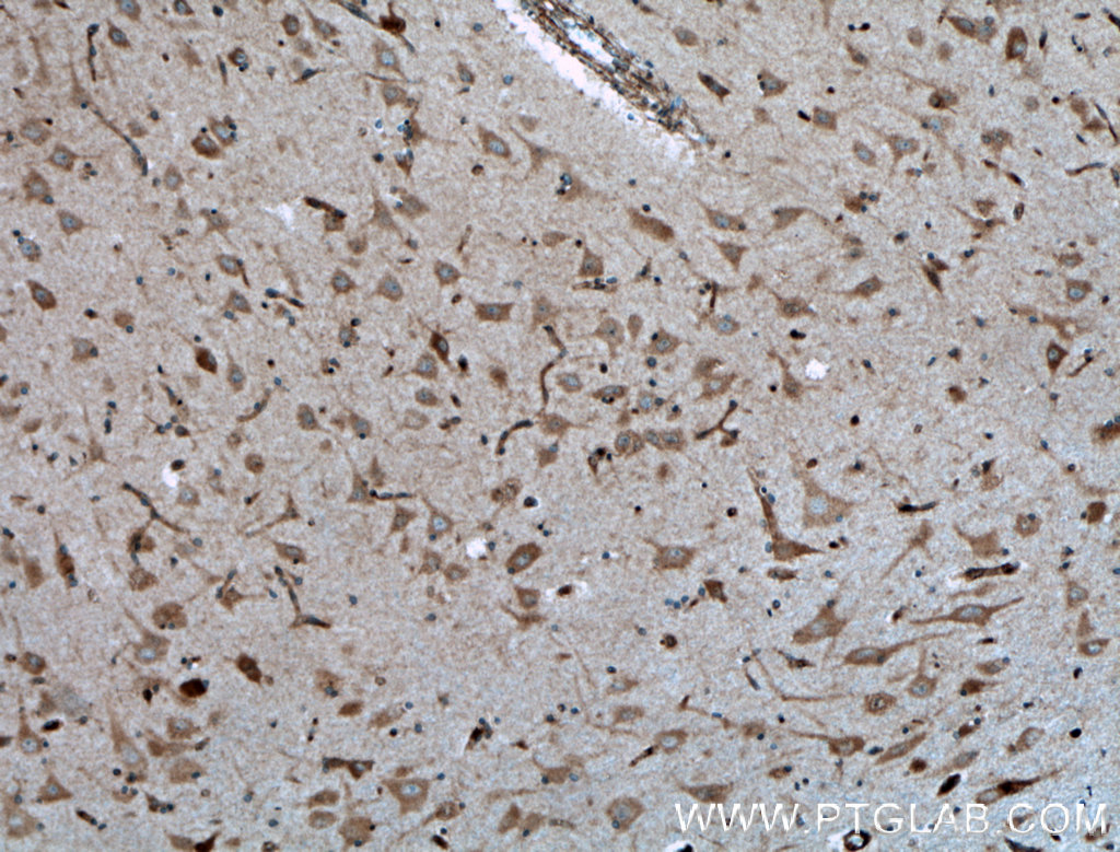 IHC staining of human brain using 26950-1-AP