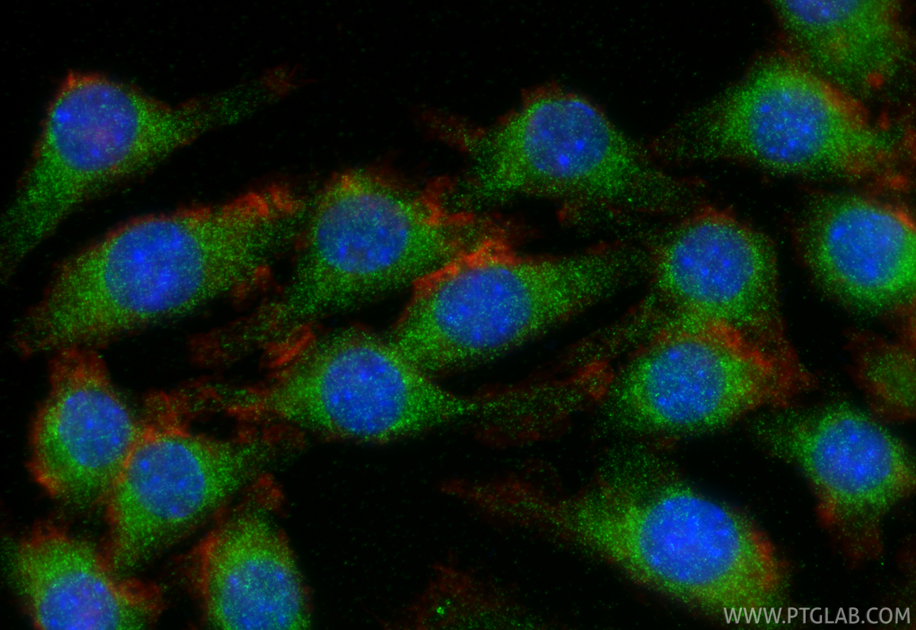IF Staining of J774A.1 using 29491-1-AP IF Staining of J774A.1 using 29491-1-AP