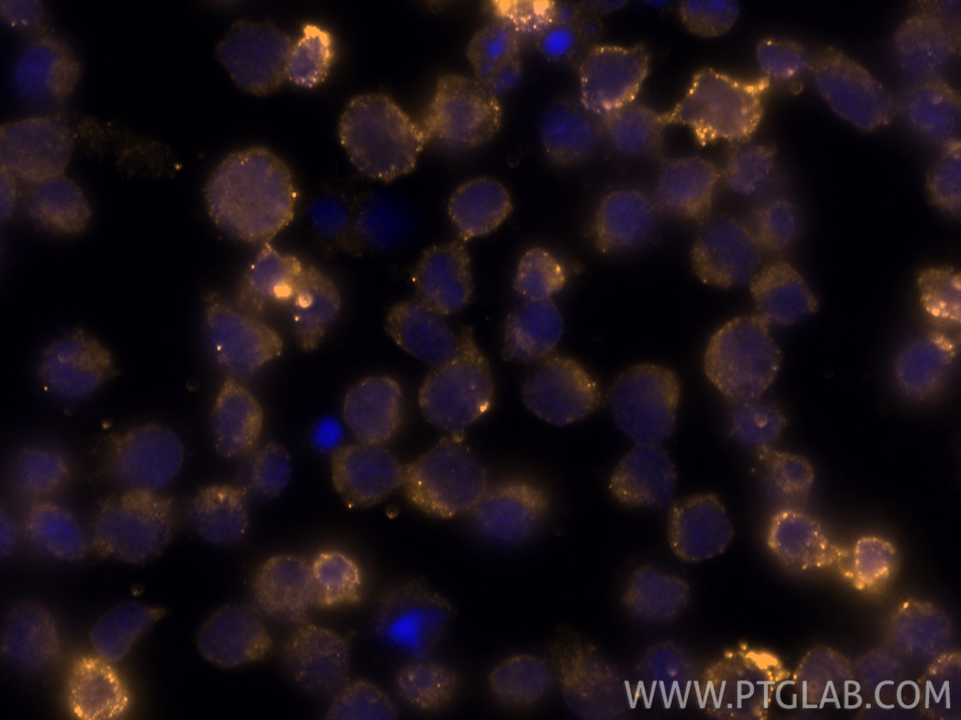 Immunofluorescent analysis of (4% PFA) fixed Jurkat cells using CoraLite® Plus 555 Granzyme B antibody (CL555-13588) at dilution of 1:200. IF Staining of Jurkat using CL555-13588