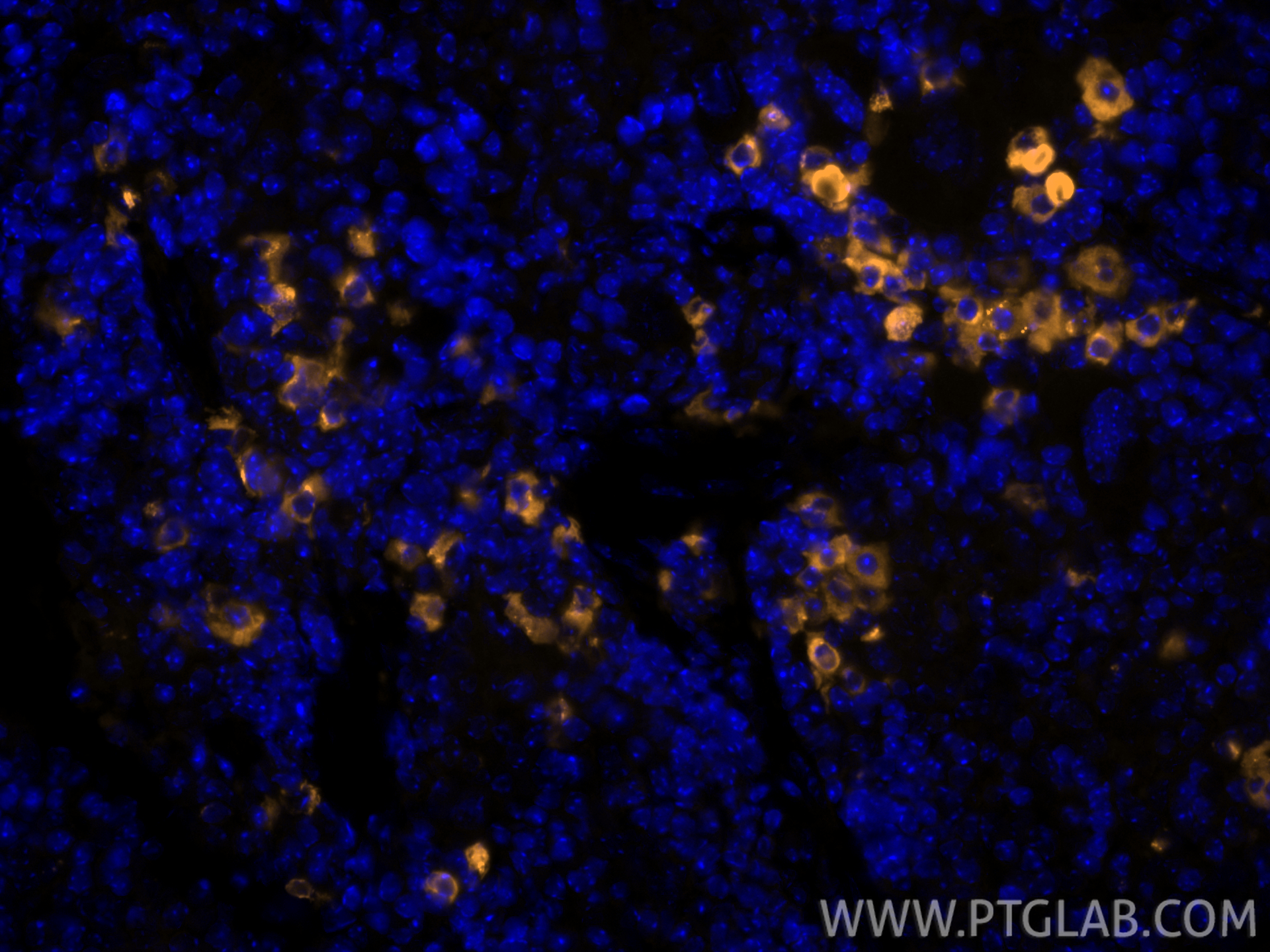 IF Staining of mouse spleen using CL555-13588 IF Staining of mouse spleen using CL555-13588