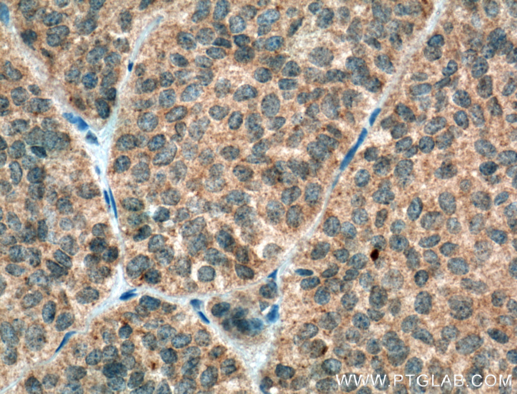 GH1 Polyclonal antibody