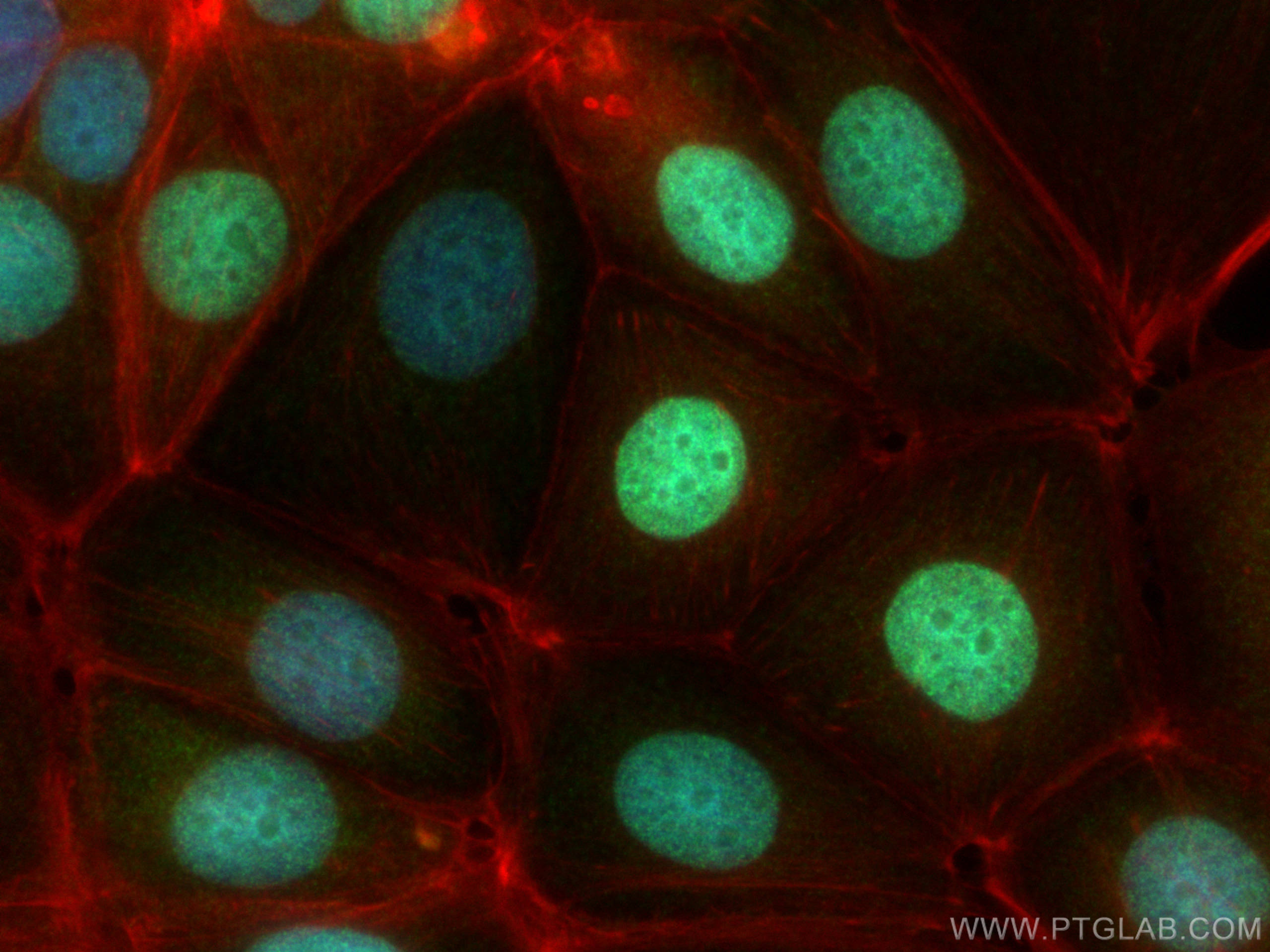 IF Staining of MCF-7 using 17510-1-AP