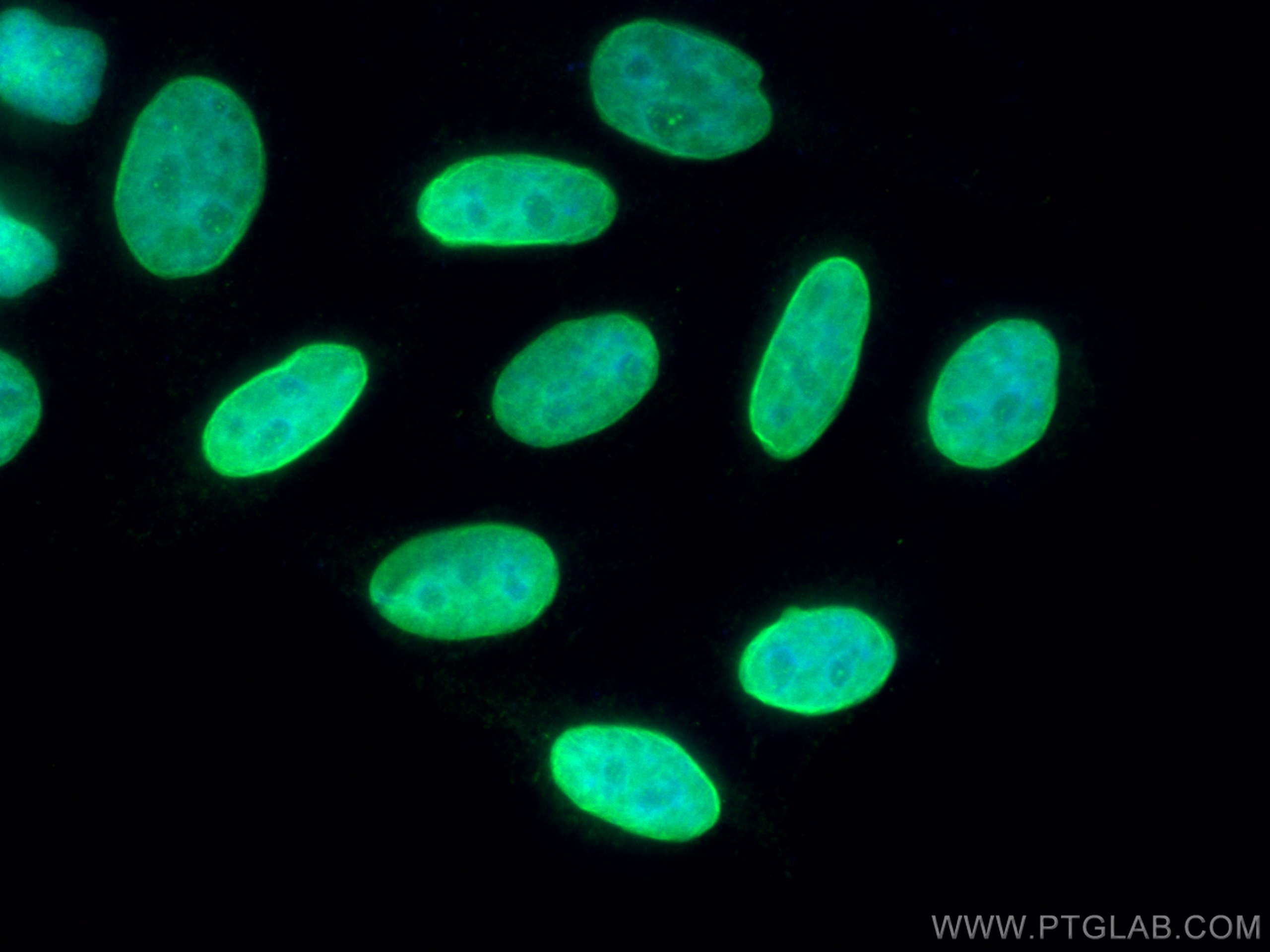 IF Staining of HepG2 using 26875-1-AP