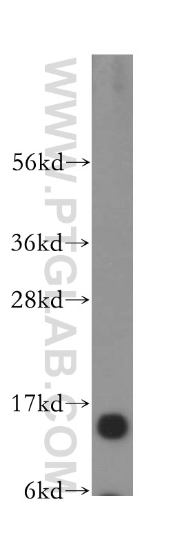 WB analysis of human brain using 16441-1-AP