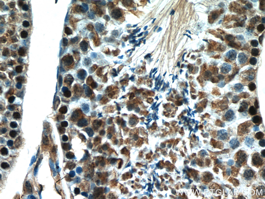 IHC staining of mouse testis using 13754-1-AP