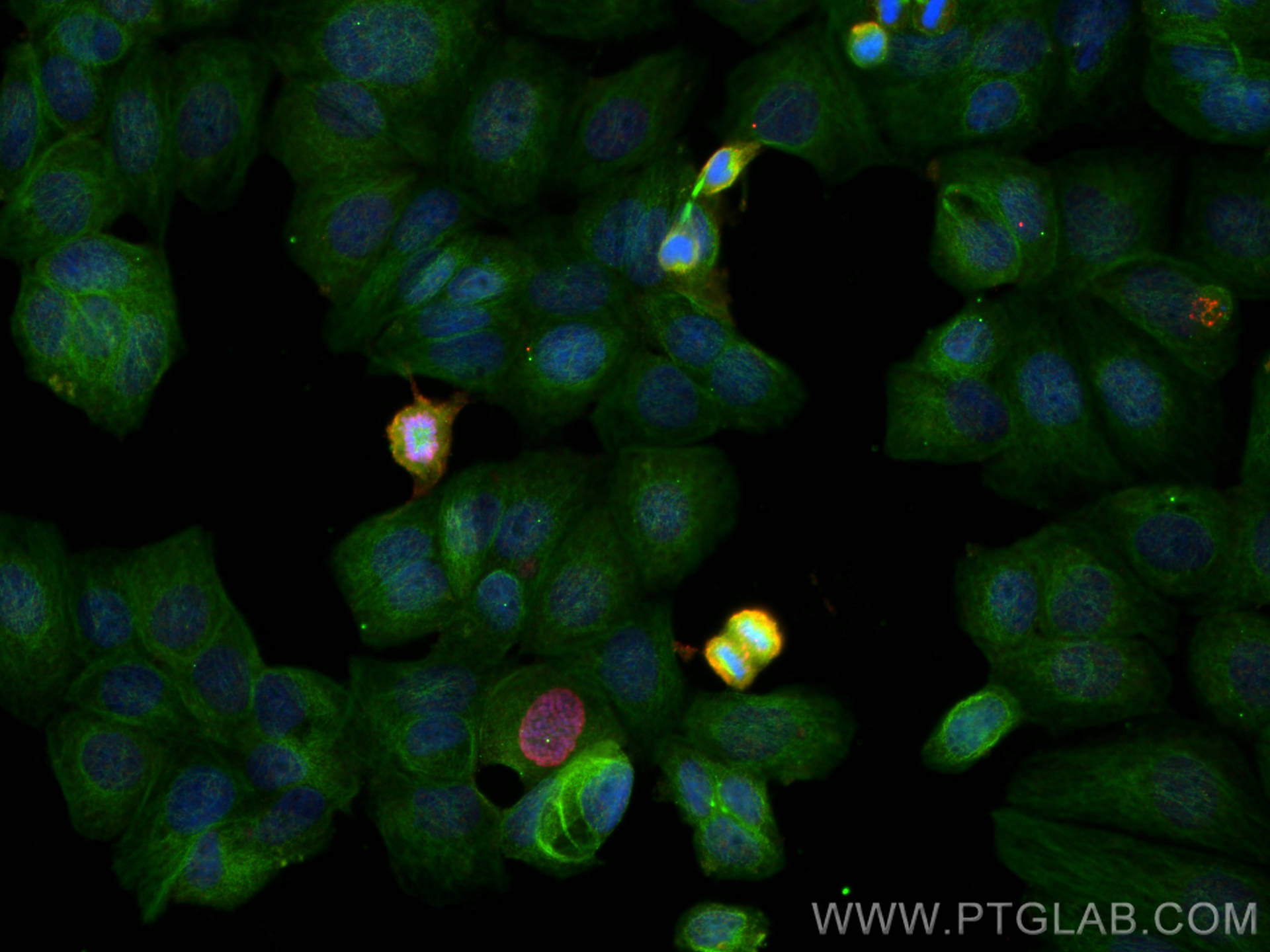 IF Staining of MCF-7 using 66863-1-Ig (same clone as 66863-1-PBS)