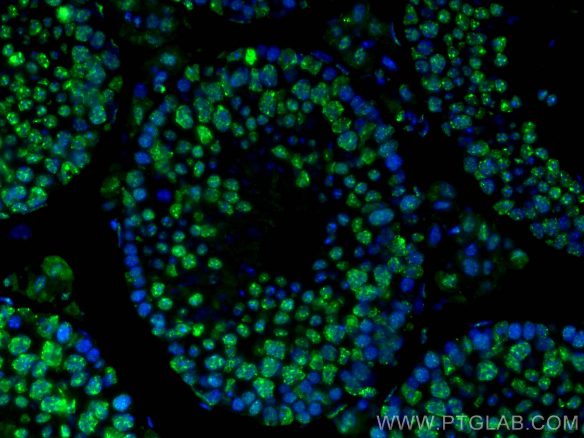 IF Staining of mouse testis using 66863-1-Ig (same clone as 66863-1-PBS)
