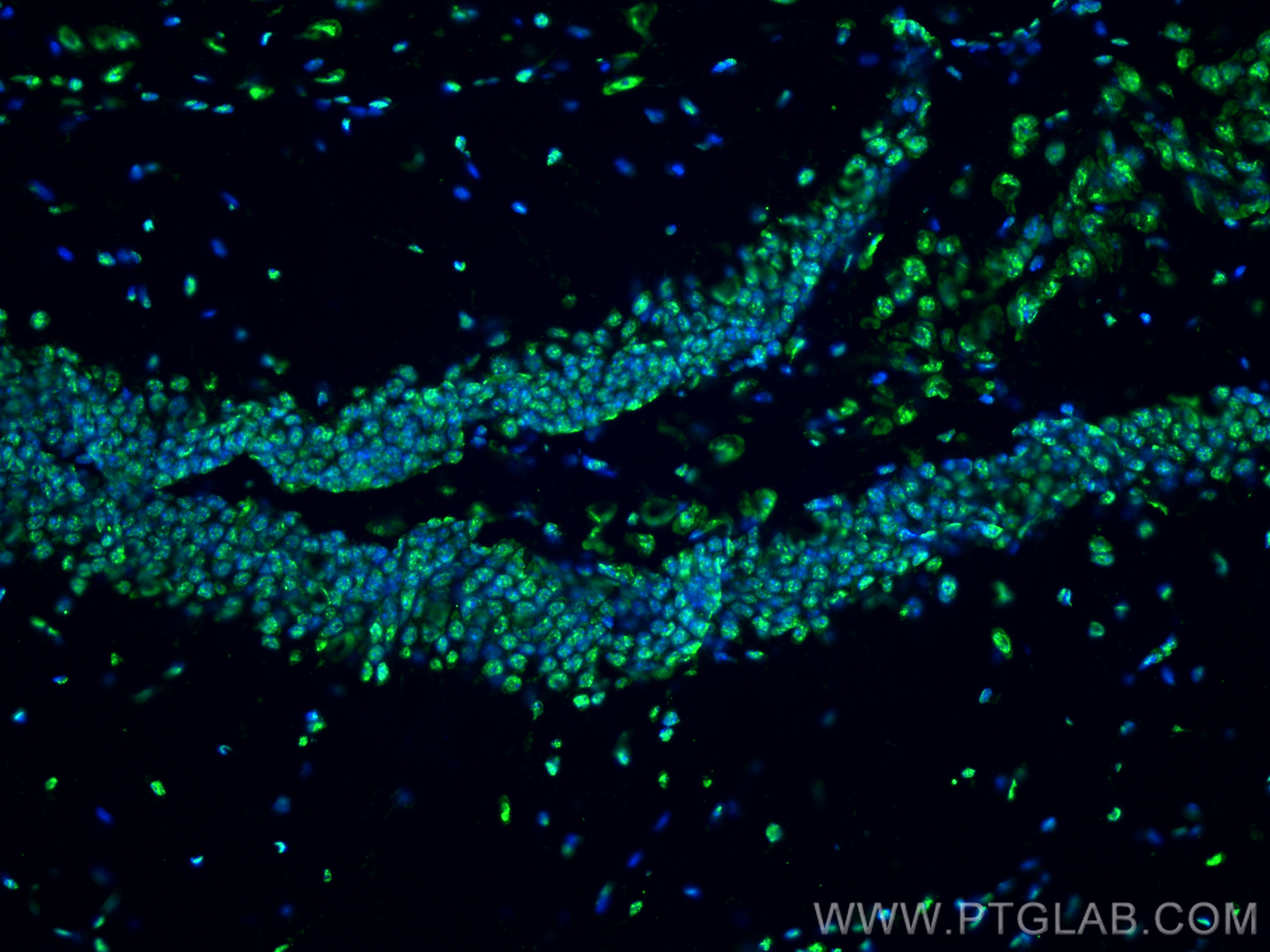 IF Staining of mouse brain using 66863-1-Ig (same clone as 66863-1-PBS)