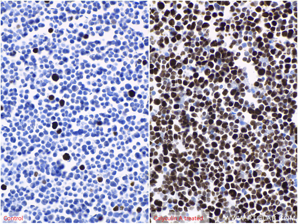 IHC staining of Jurkat using 66863-1-Ig