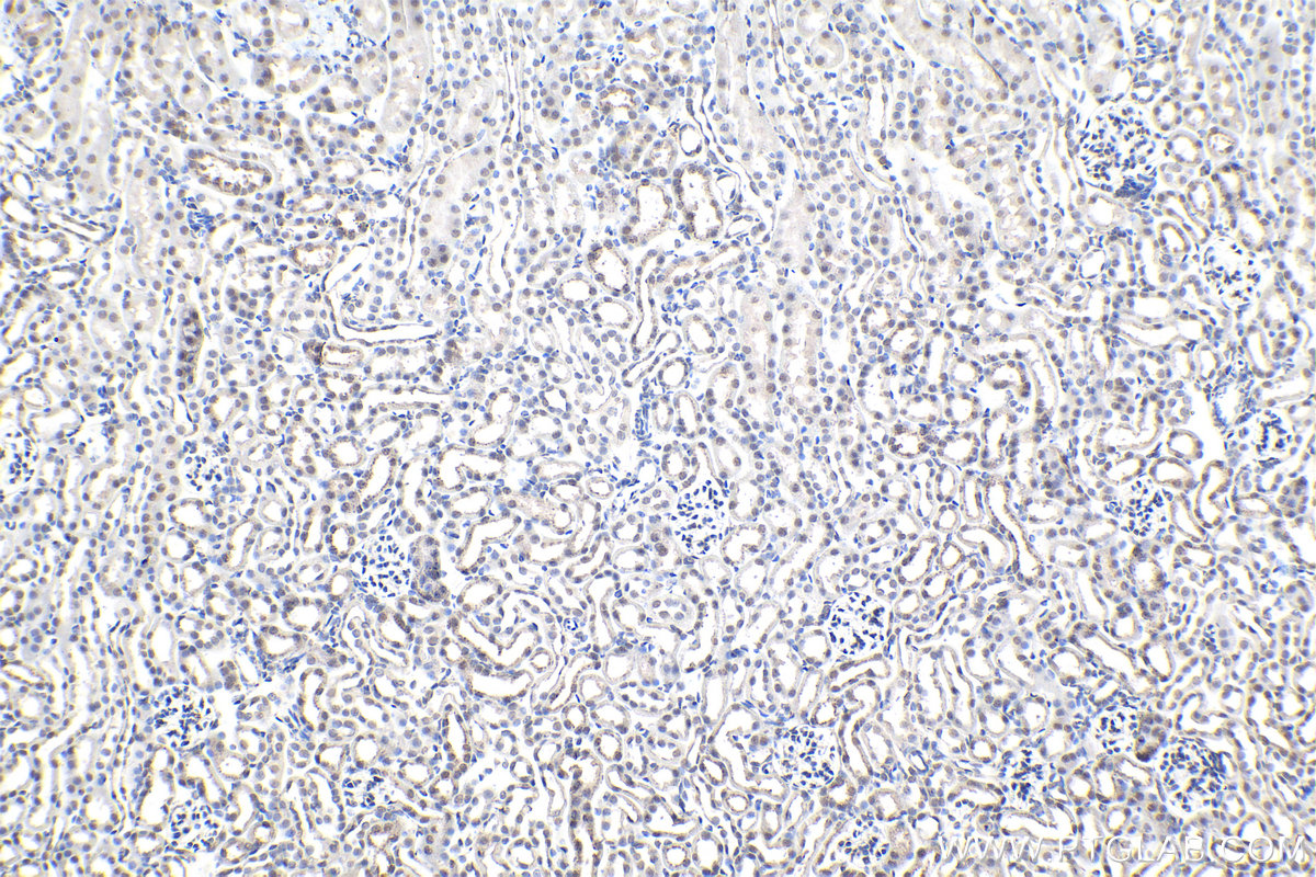 IHC staining of mouse kidney using 66863-1-Ig (same clone as 66863-1-PBS)