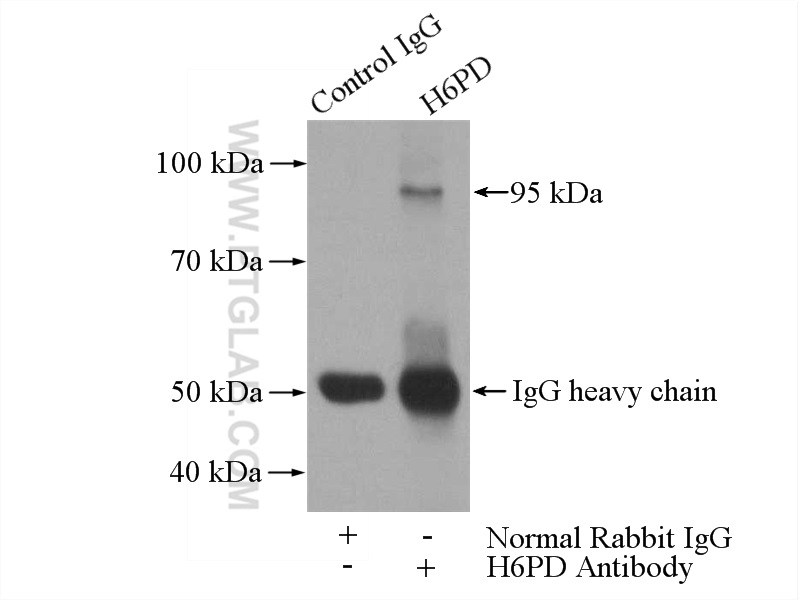 IP experiment of HepG2 using 15255-1-AP