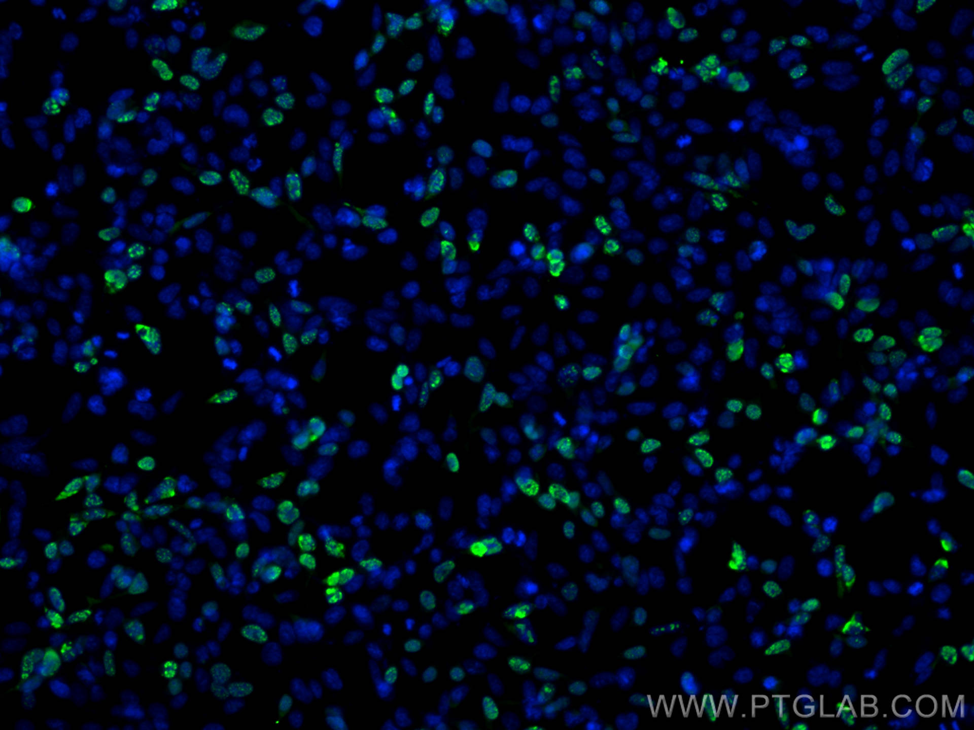IF Staining of Transfected HEK-293 using 81290-1-RR (same clone as 81290-1-PBS)