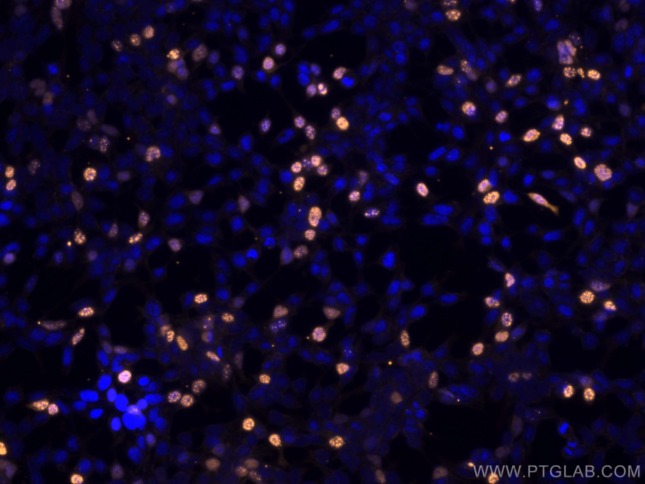 IF Staining of Transfected HEK-293 using CL555-66006