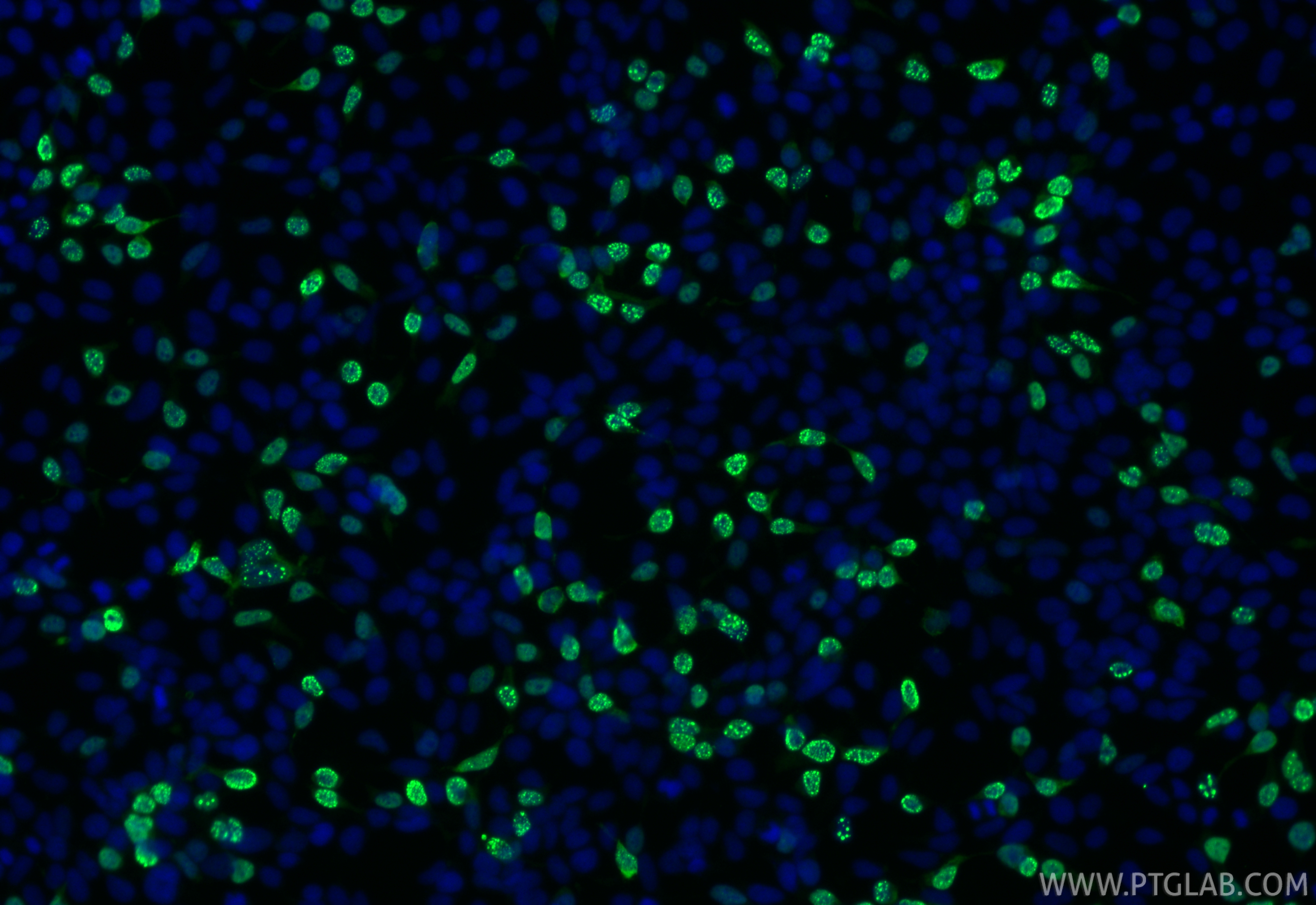 IF Staining of Transfected HEK-293 using 51064-2-AP