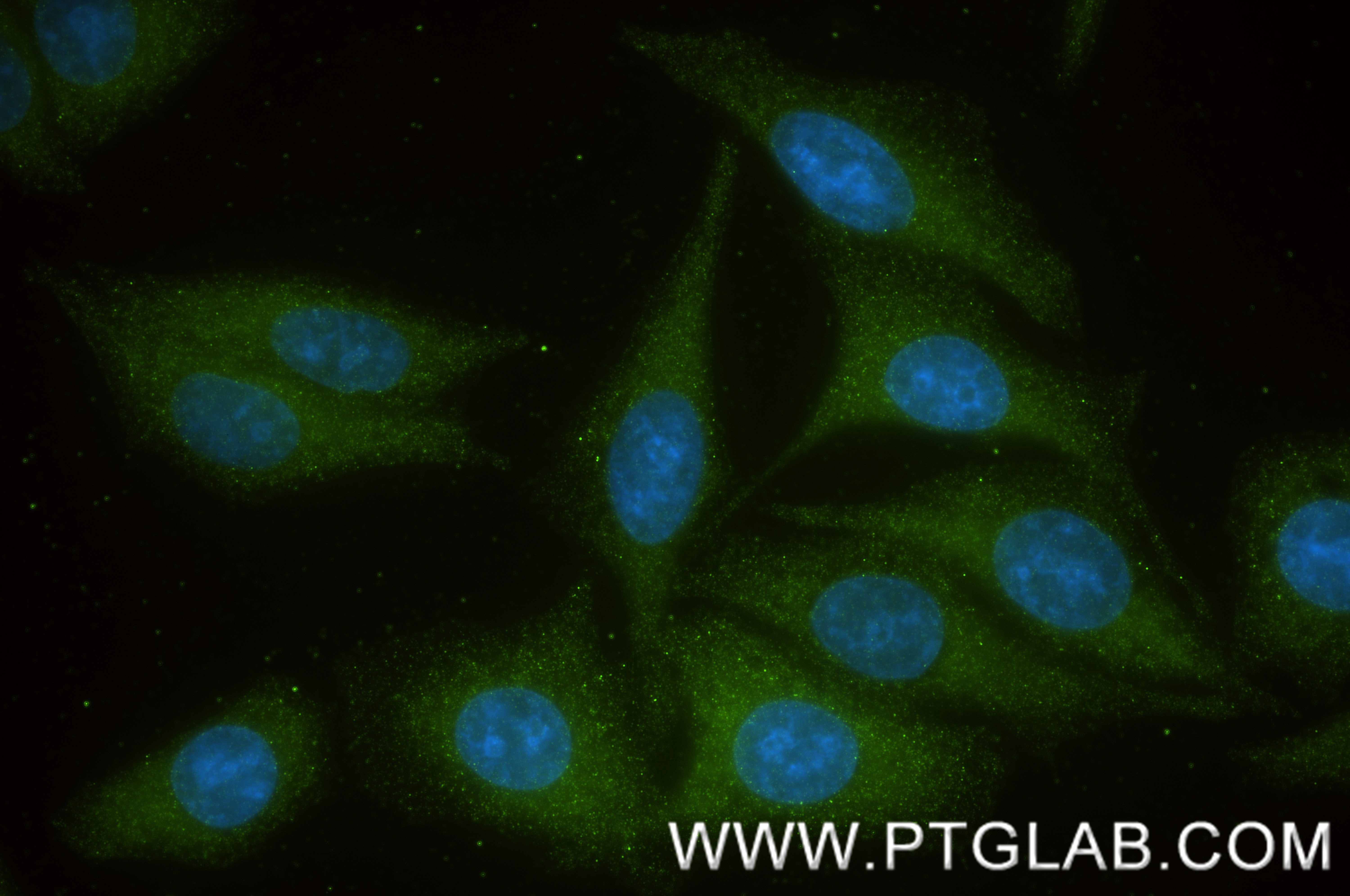 IF Staining of HepG2 using 86673-1-RR (same clone as 86673-1-PBS) IF Staining of HepG2 using 86673-1-RR (same clone as 86673-1-PBS)
