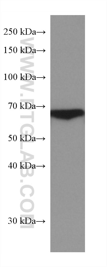 WB analysis of human plasma using 67867-1-Ig (same clone as 67867-1-PBS)