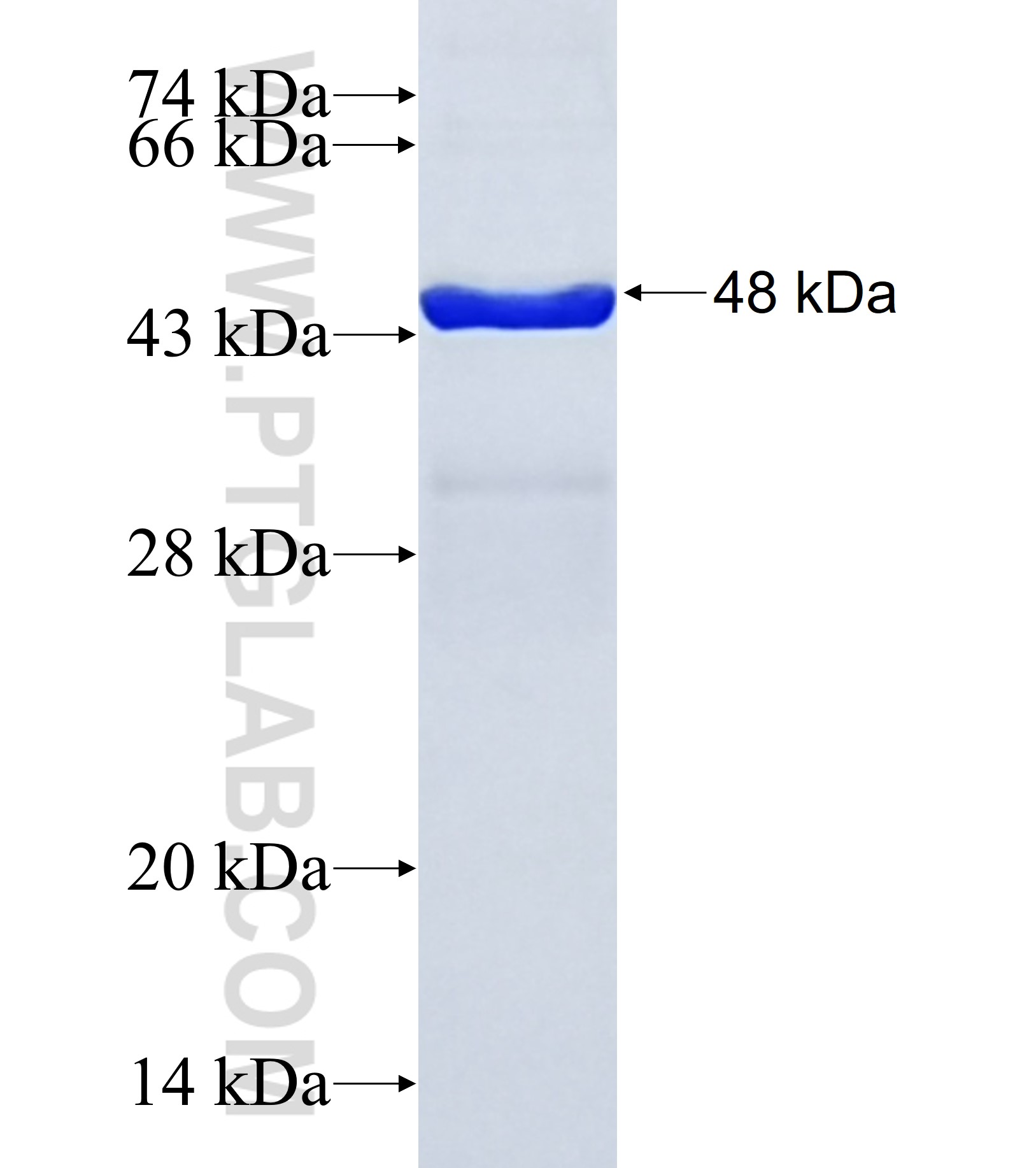 HABP2 fusion protein Ag33062 SDS-PAGE HABP2 fusion protein Ag33062 SDS-PAGE