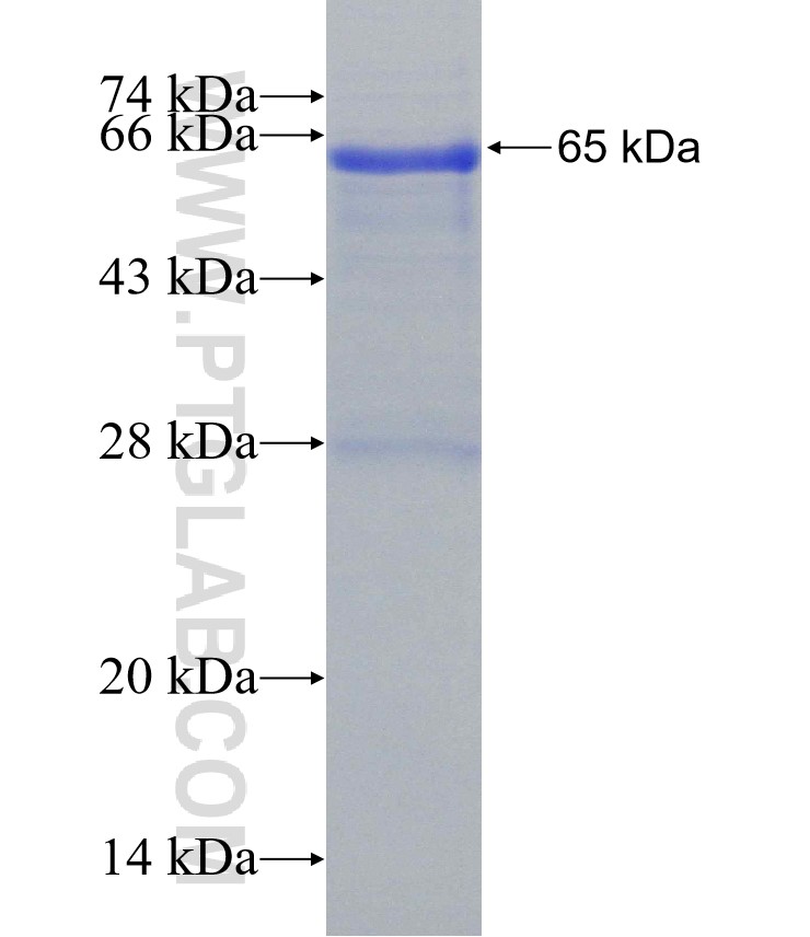 HABP2 fusion protein Ag3981 SDS-PAGE