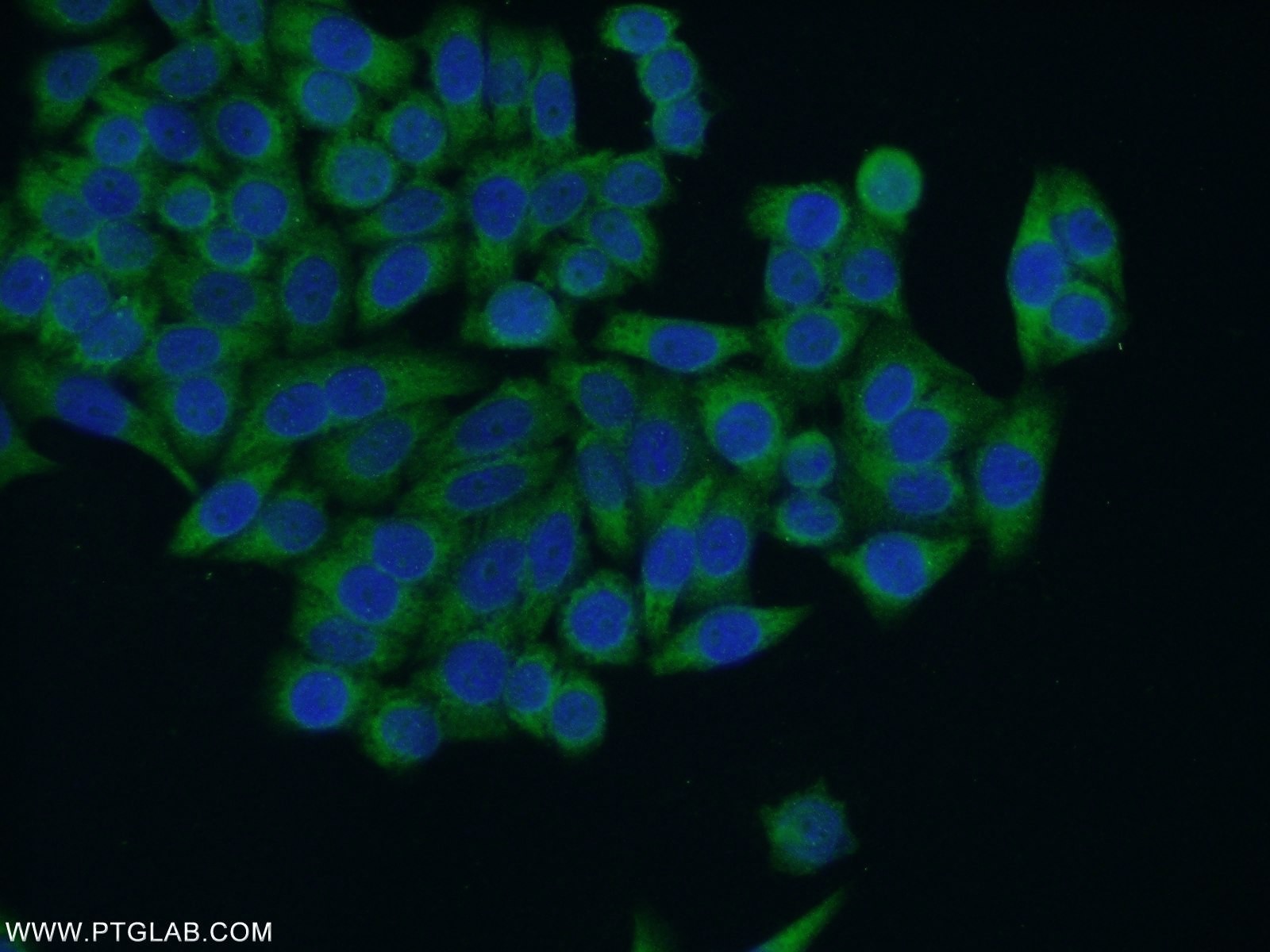 IF Staining of HeLa using 24104-1-AP