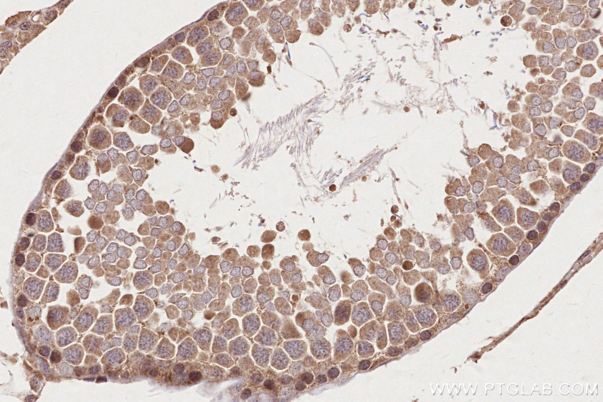 IHC staining of rat testis using 24104-1-AP
