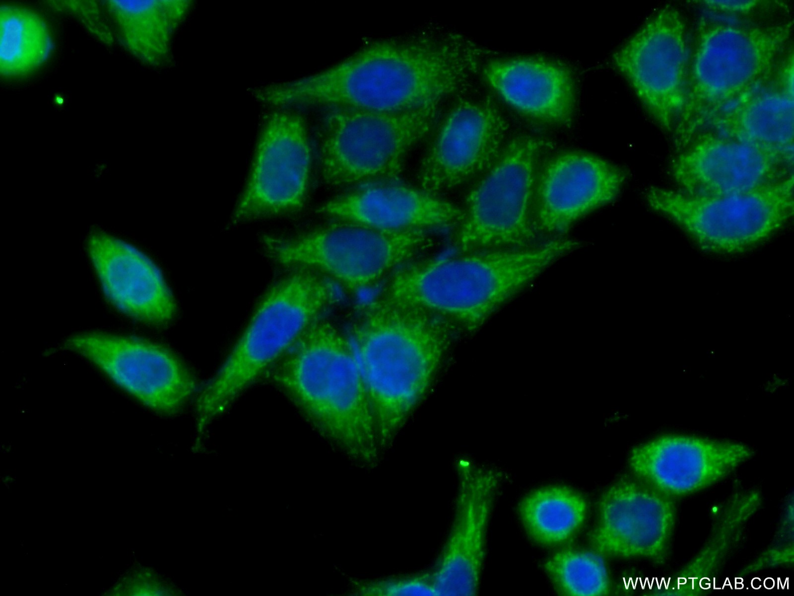 IF Staining of HeLa using 15519-1-AP