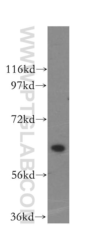 WB analysis of HeLa using 15519-1-AP