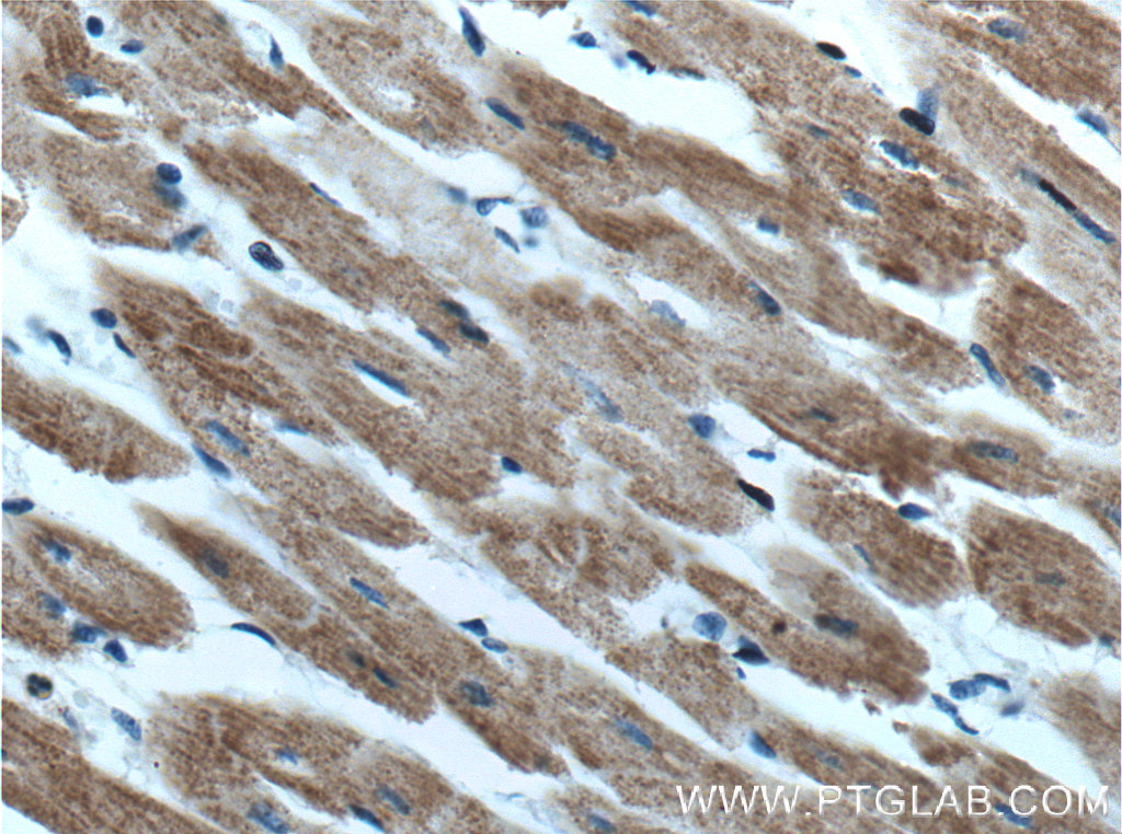 IHC staining of human heart using 10758-1-AP