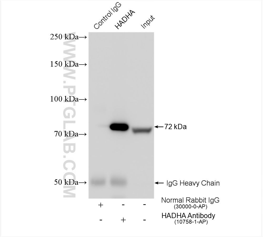 IP experiment of HeLa using 10758-1-AP