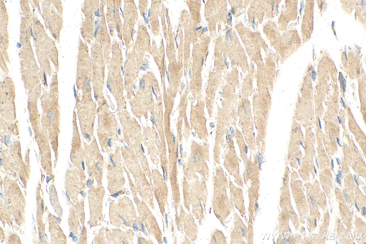 IHC staining of mouse heart using 60250-1-Ig