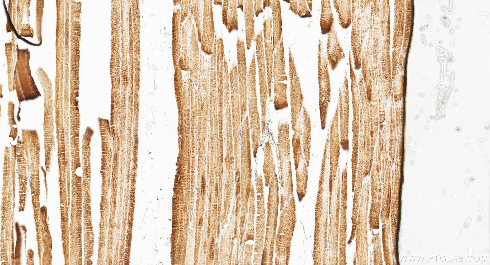 IHC staining of human skeletal muscle using 87032-3-RR (same clone as 87032-3-PBS) IHC staining of human skeletal muscle using 87032-3-RR (same clone as 87032-3-PBS)