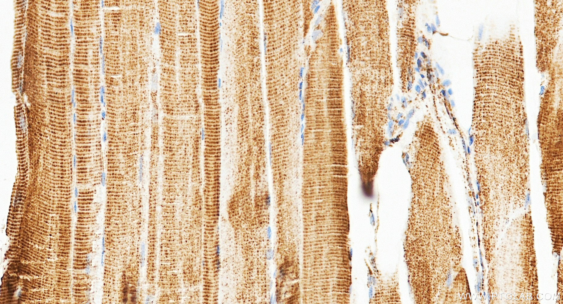 IHC staining of human skeletal muscle using 87032-3-RR (same clone as 87032-3-PBS) IHC staining of human skeletal muscle using 87032-3-RR (same clone as 87032-3-PBS)
