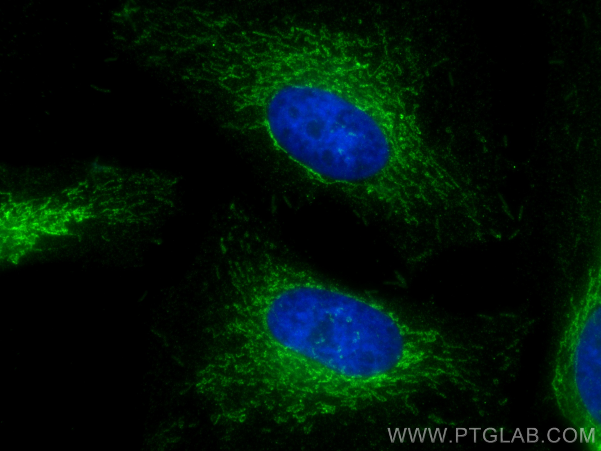 IF Staining of HeLa using 67967-1-Ig (same clone as 67967-1-PBS)