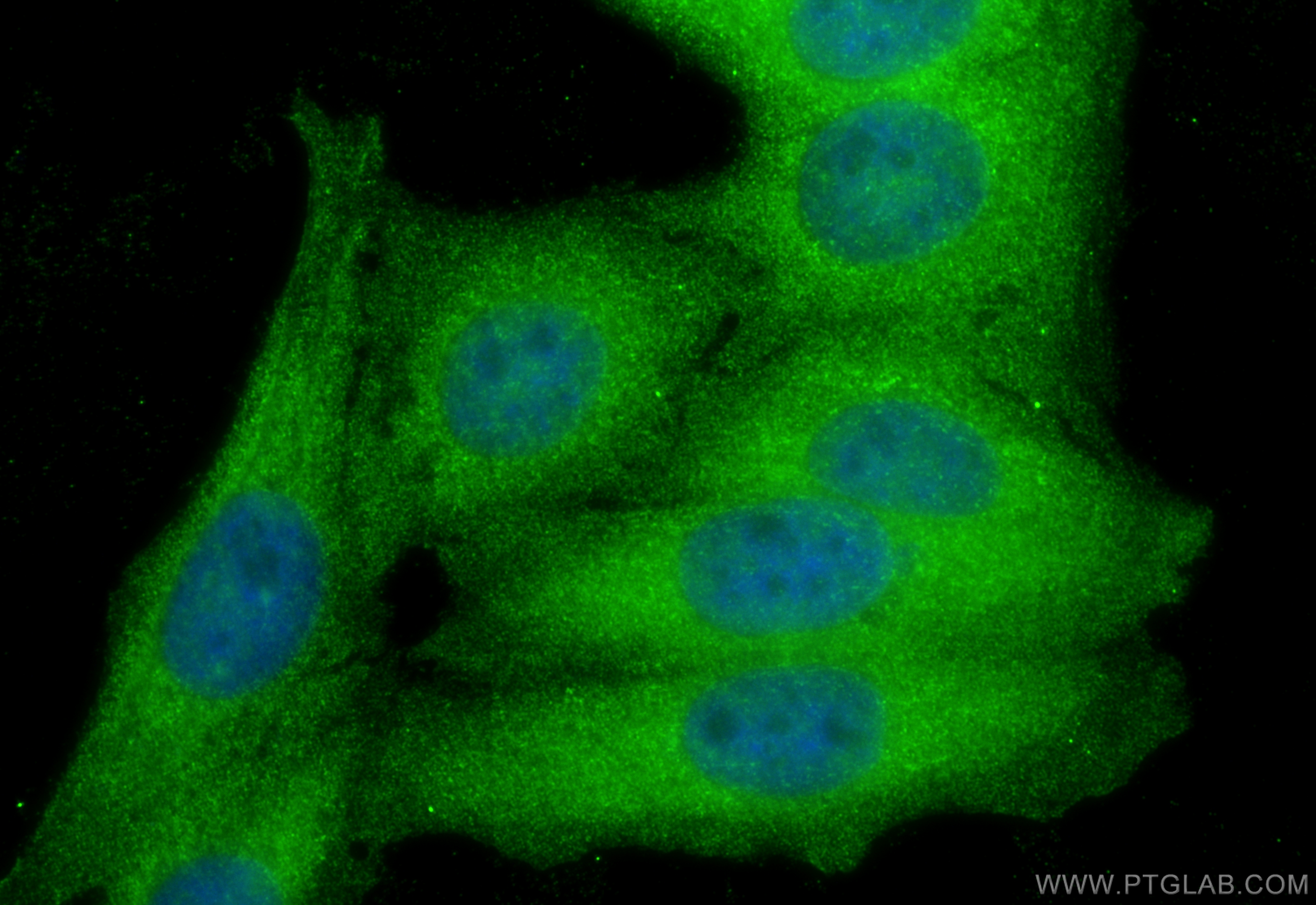 IF Staining of HepG2 using 17196-1-AP IF Staining of HepG2 using 17196-1-AP
