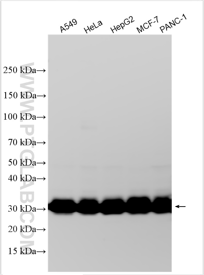 Various lysates were subjected to SDS PAGE followed by western blot with 17196-1-AP (GLO2 antibody) at dilution of 1:5000 incubated at room temperature for 1.5 hours. WB analysis using 17196-1-AP