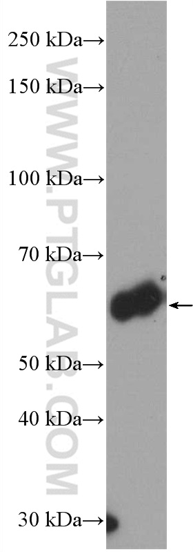 WB analysis of human placenta using 27593-1-AP