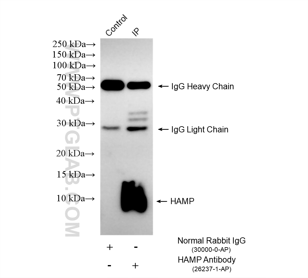 IP experiment of HepG2 using 26237-1-AP (same clone as 26237-1-PBS) IP experiment of HepG2 using 26237-1-AP (same clone as 26237-1-PBS)