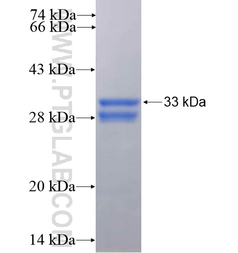 HAND2 fusion protein Ag16038 SDS-PAGE HAND2 fusion protein Ag16038 SDS-PAGE