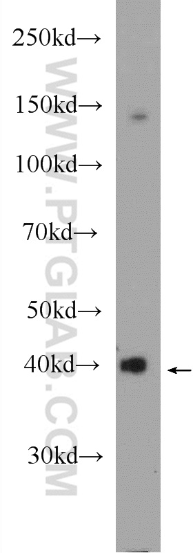 HAO1 Polyclonal antibody