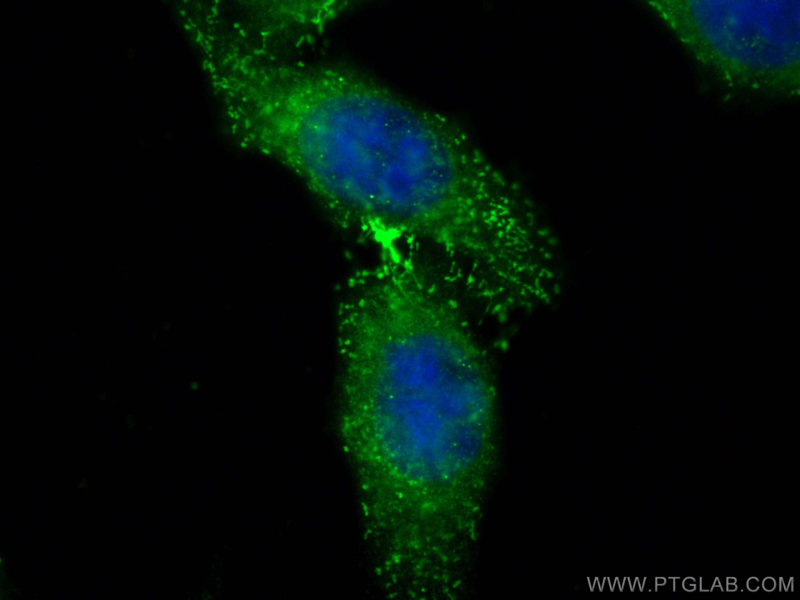IF Staining of HepG2 using 16563-1-AP