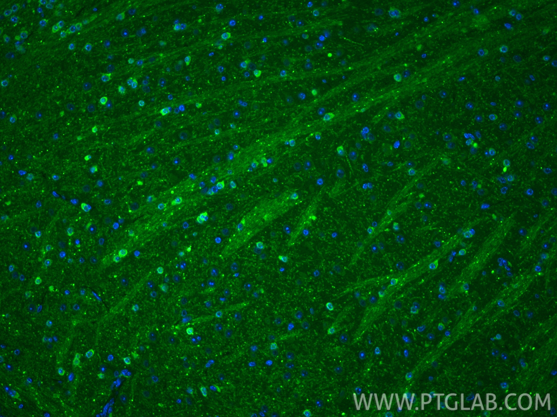 IF Staining of mouse brain using 27818-1-AP IF Staining of mouse brain using 27818-1-AP
