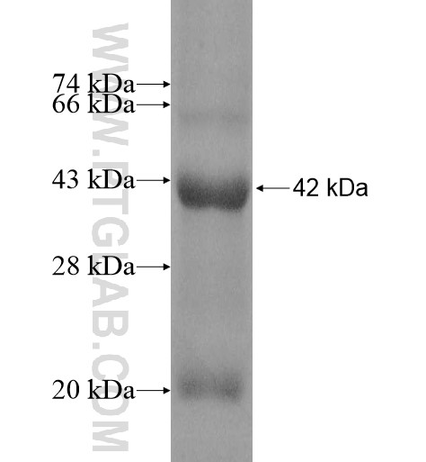 HAPLN3 fusion protein Ag12049 SDS-PAGE HAPLN3 fusion protein Ag12049 SDS-PAGE