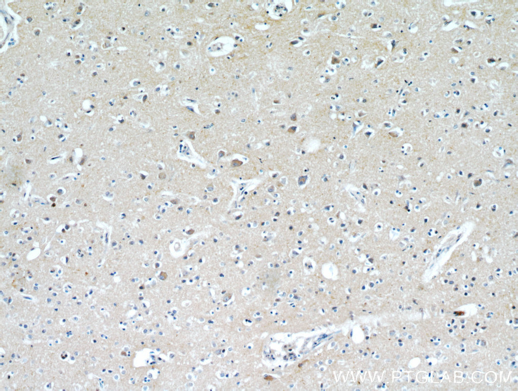 IHC staining of human brain using 21228-1-AP