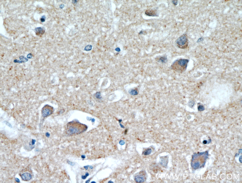 IHC staining of human brain using 21228-1-AP