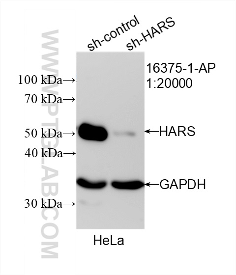 WB analysis of HeLa using 16375-1-AP