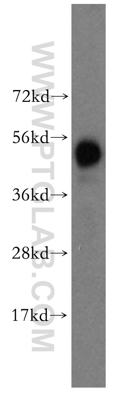 WB analysis of mouse liver using 16375-1-AP