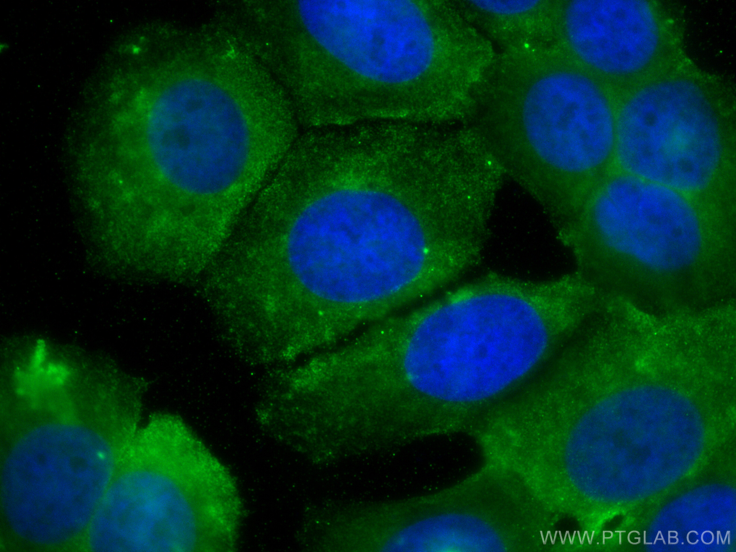 IF Staining of MCF-7 using 67662-1-Ig (same clone as 67662-1-PBS)