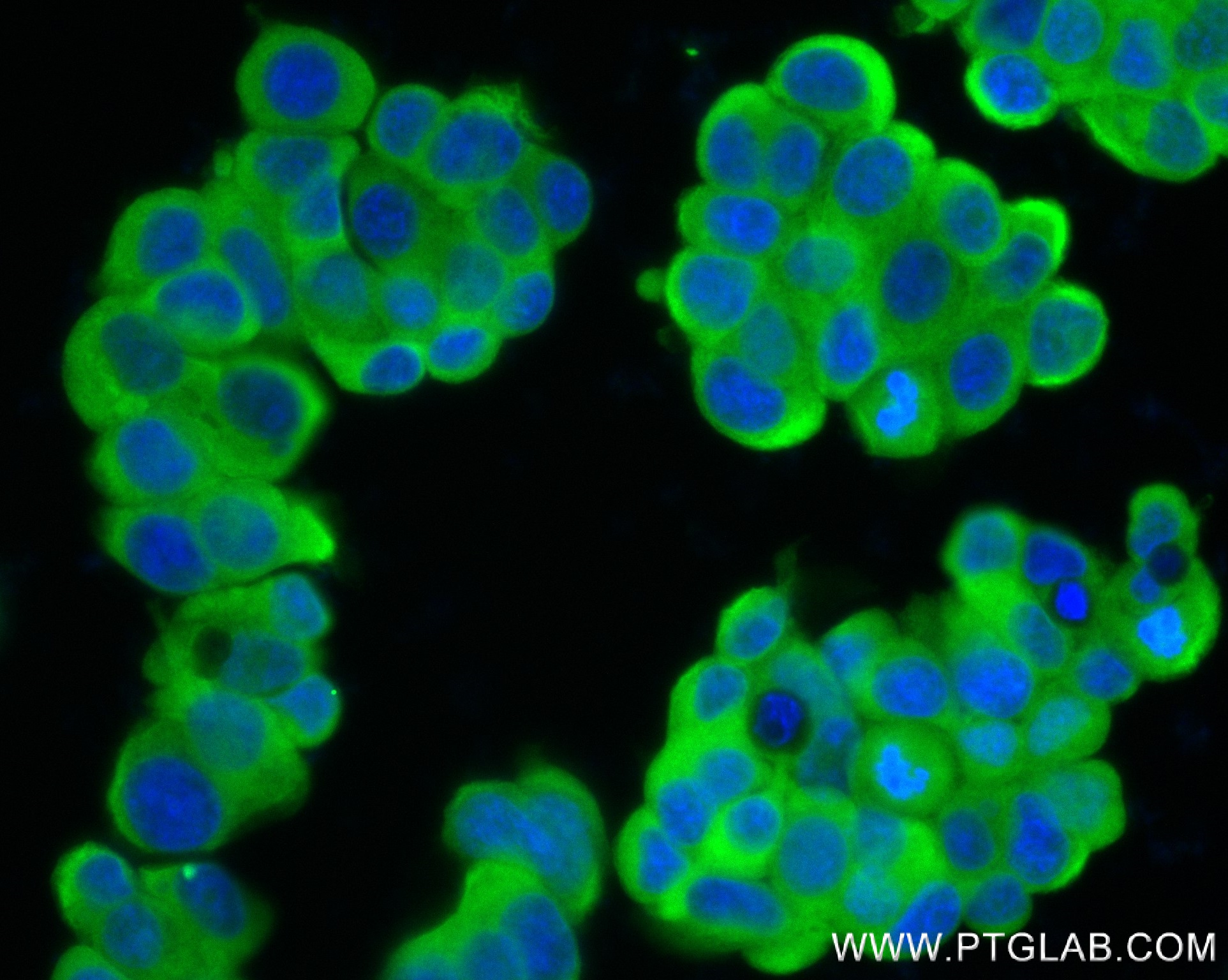 IF Staining of MCF-7 using 83497-1-RR (same clone as 83497-1-PBS)
