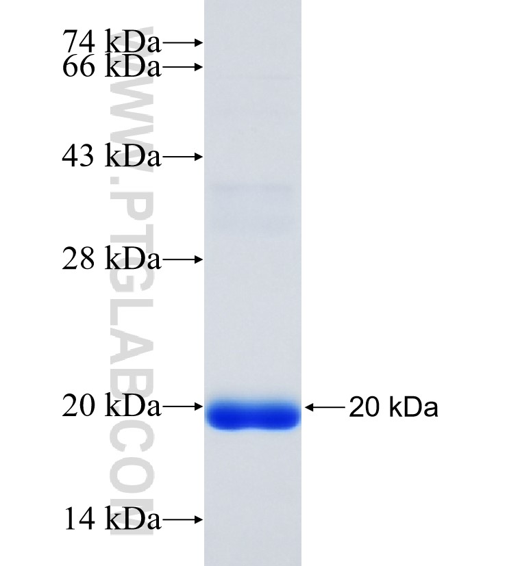 HAS2 fusion protein Ag34972 SDS-PAGE HAS2 fusion protein Ag34972 SDS-PAGE