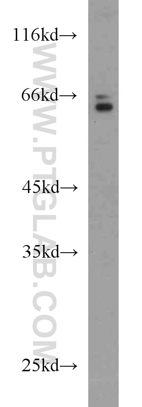 HAS3 Polyclonal antibody